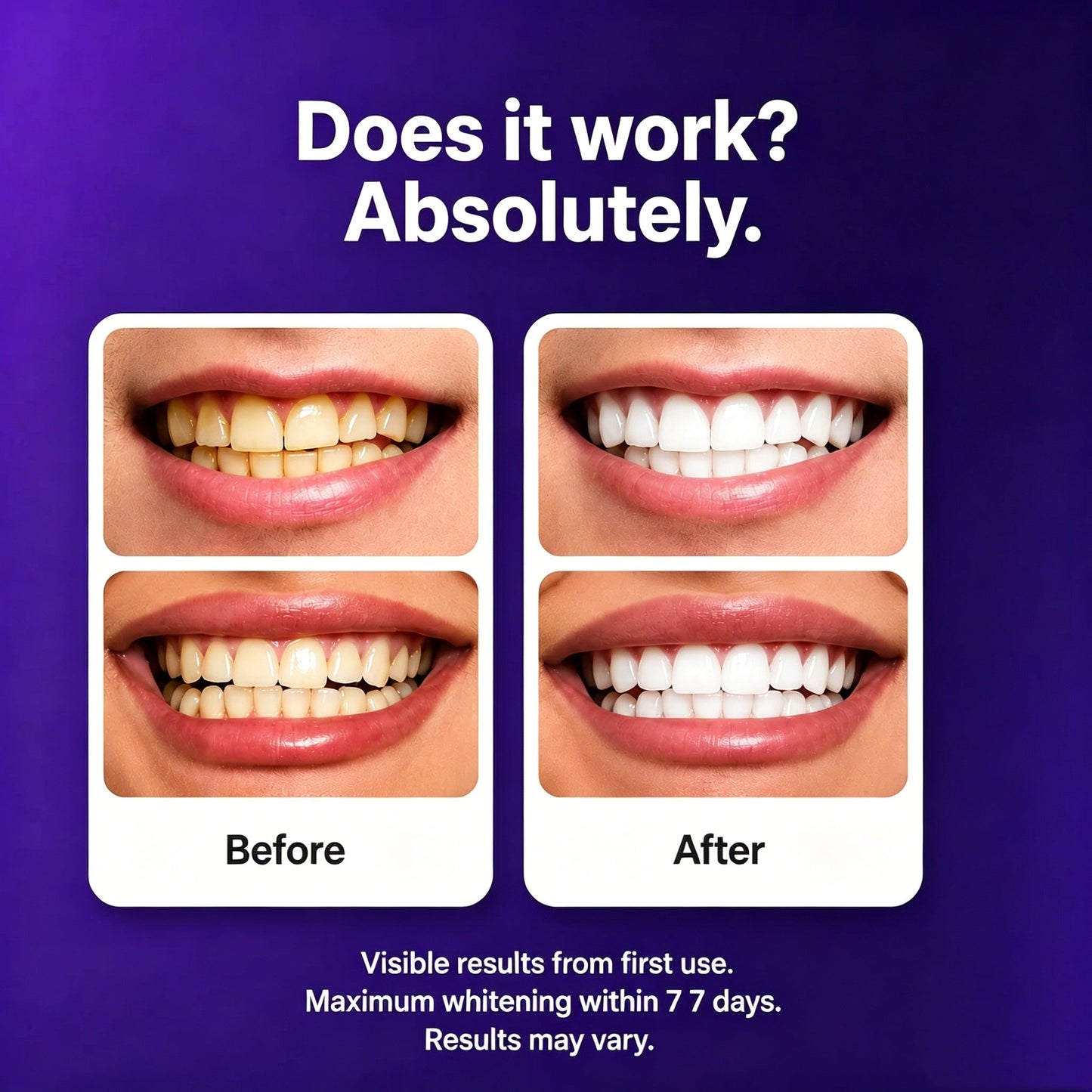 Gen-2 Purple Teeth Whitening Strips