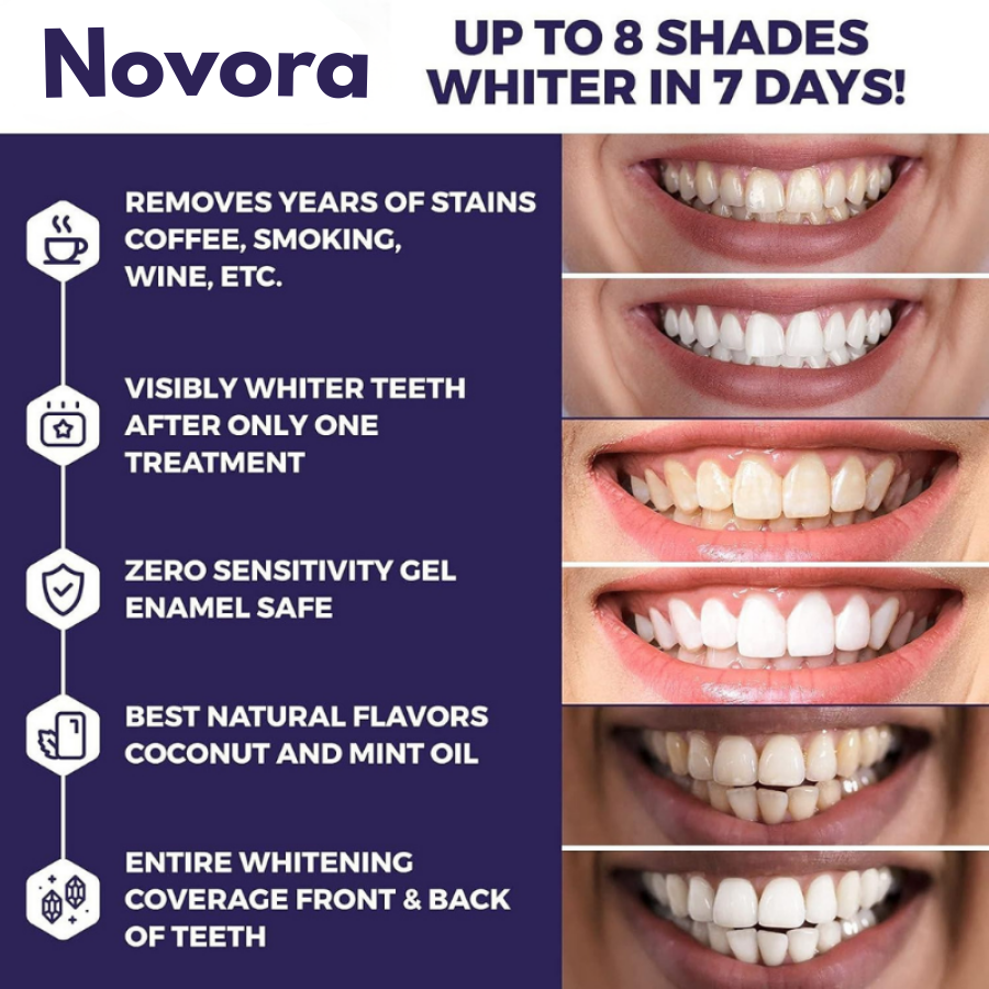 Gen-2 Purple Teeth Whitening Strips